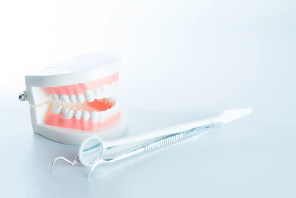 Estética dental y blanqueamiento en Alcalá de Henares