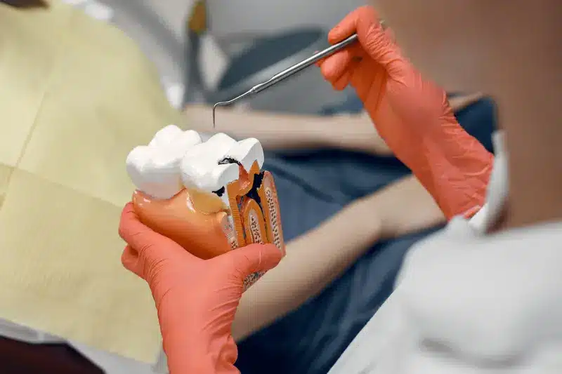 Diagnóstico periodontal con modelo dental en Clínica DentoSmile