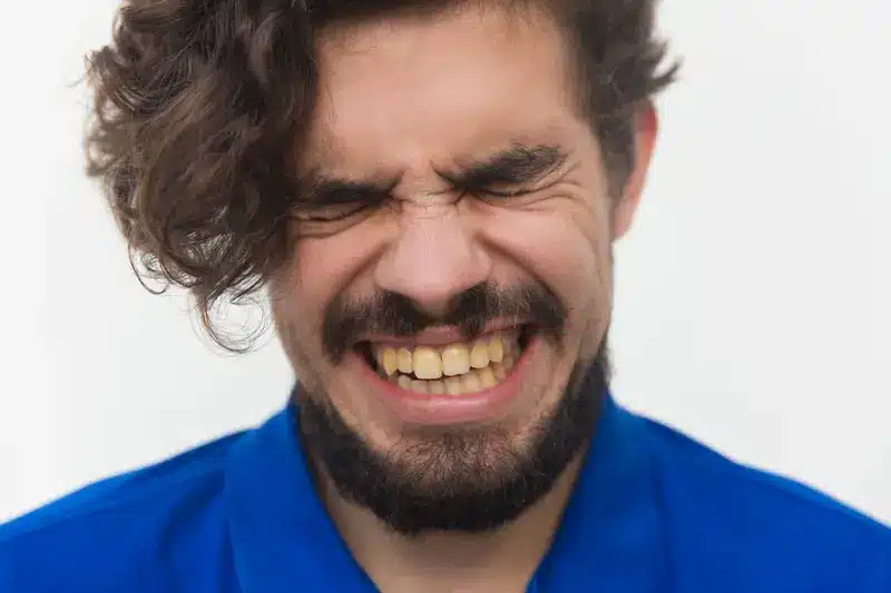 Persona con dientes amarillos mostrando cambio de color en el esmalte dental