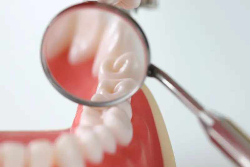 Revisión periodontal con espejo dental en Clínica DentoSmile Alcalá de Henares