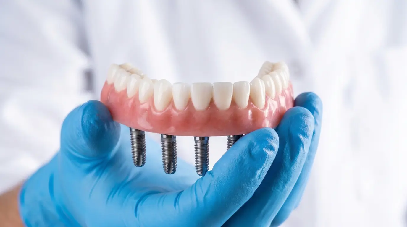 Rehabilitación completa con implantes dentales