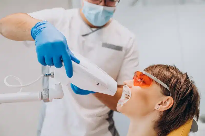 Blanqueamiento dental con lámpara LED