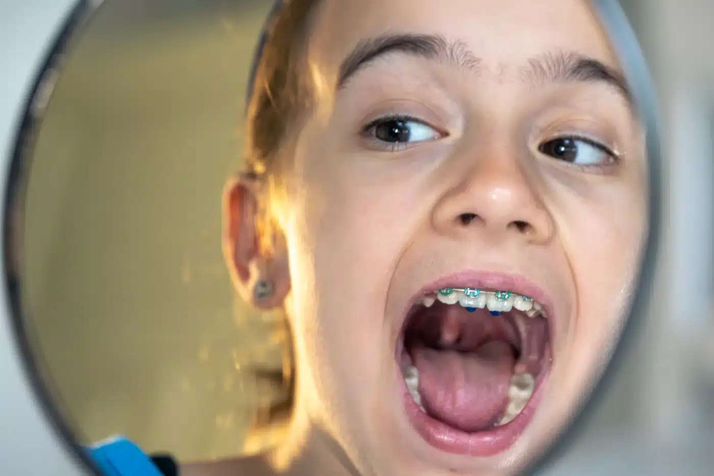 Dentista infantil en Alcalá de Henares para revisión dental, dentición mixta y seguimiento de ortodoncia