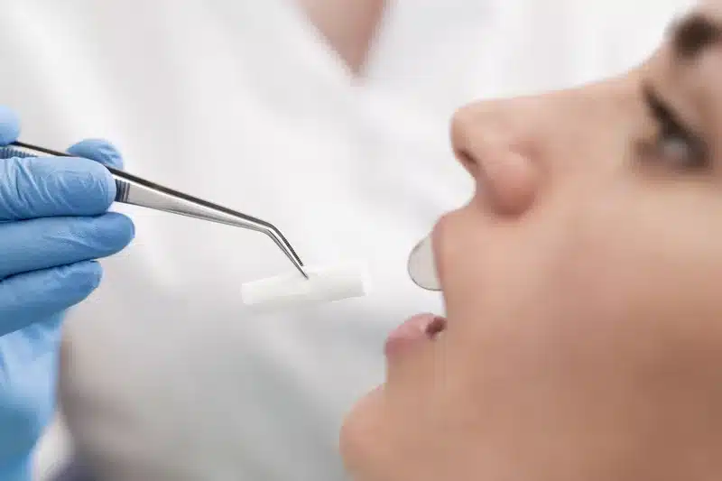 Empastes estéticos dentales