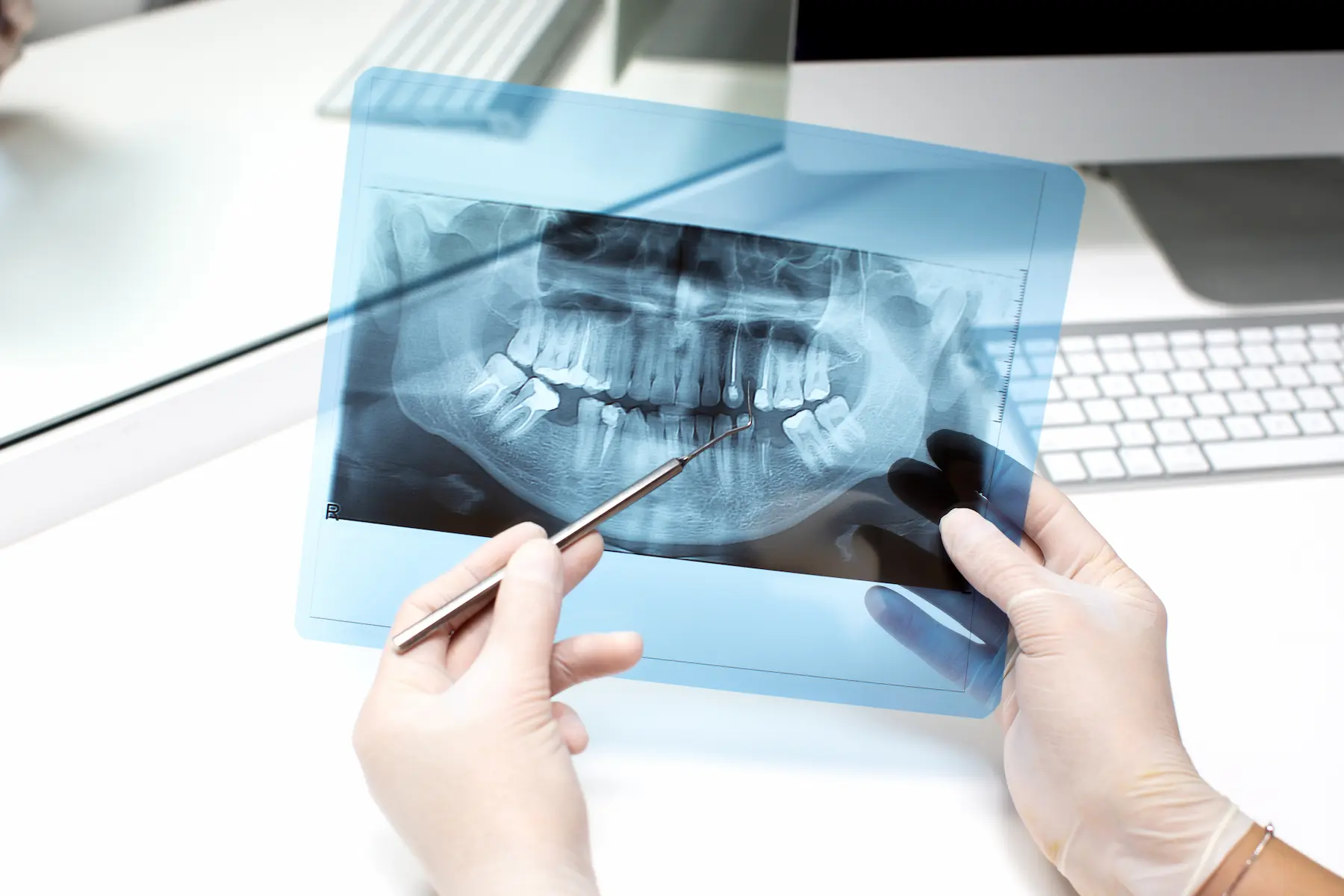 Dentista analizando una radiografía dental 3D en pantalla