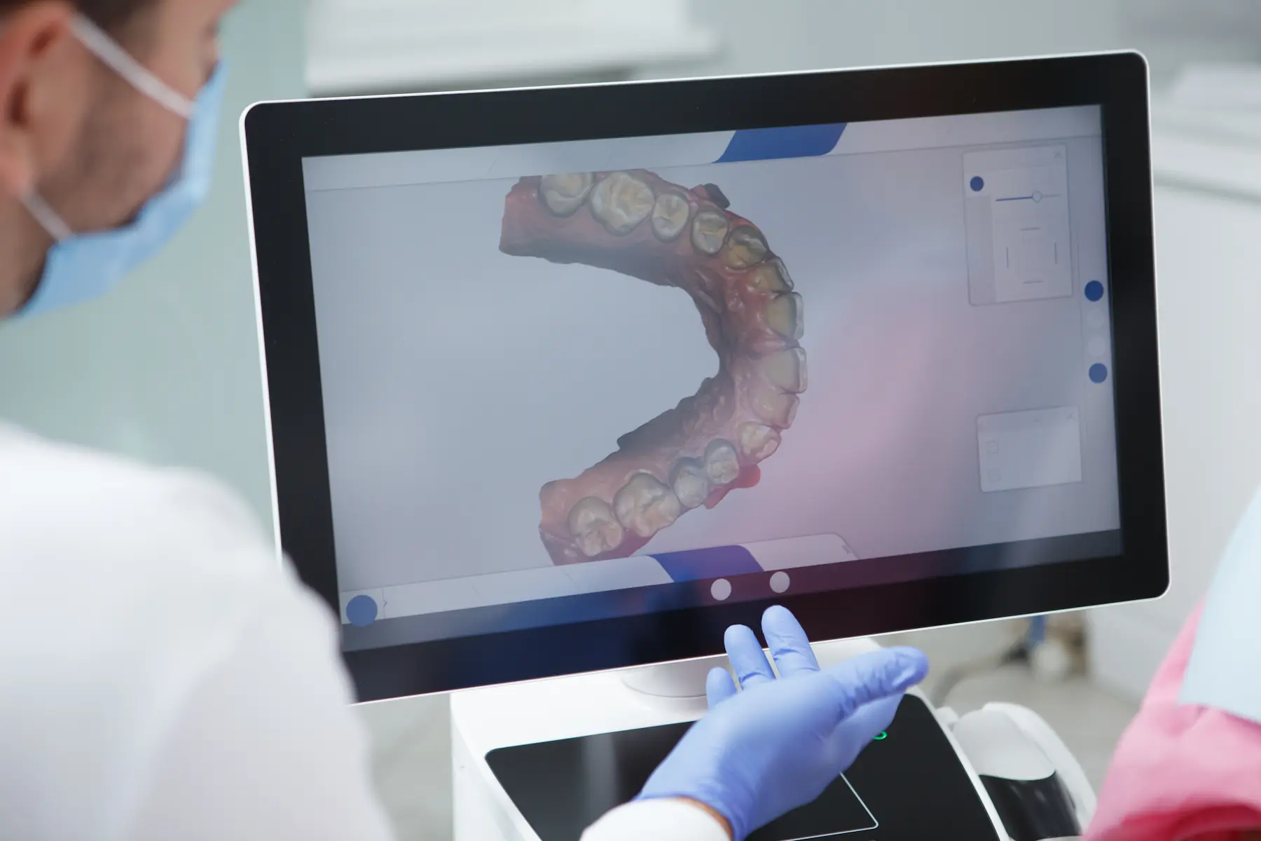 Radiografía dental 3D obtenida con escáner CBCT para diagnóstico preciso